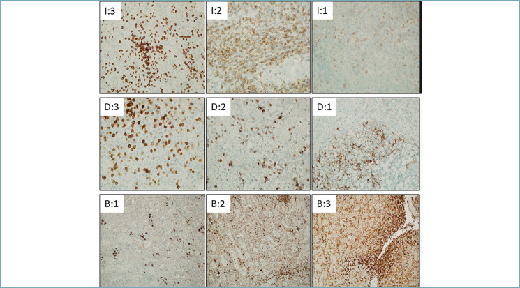 One protocol to rule them all: a pilot study to identify the best fixation and decalcification approach for bone marrow biopsy immunohistochemistry.