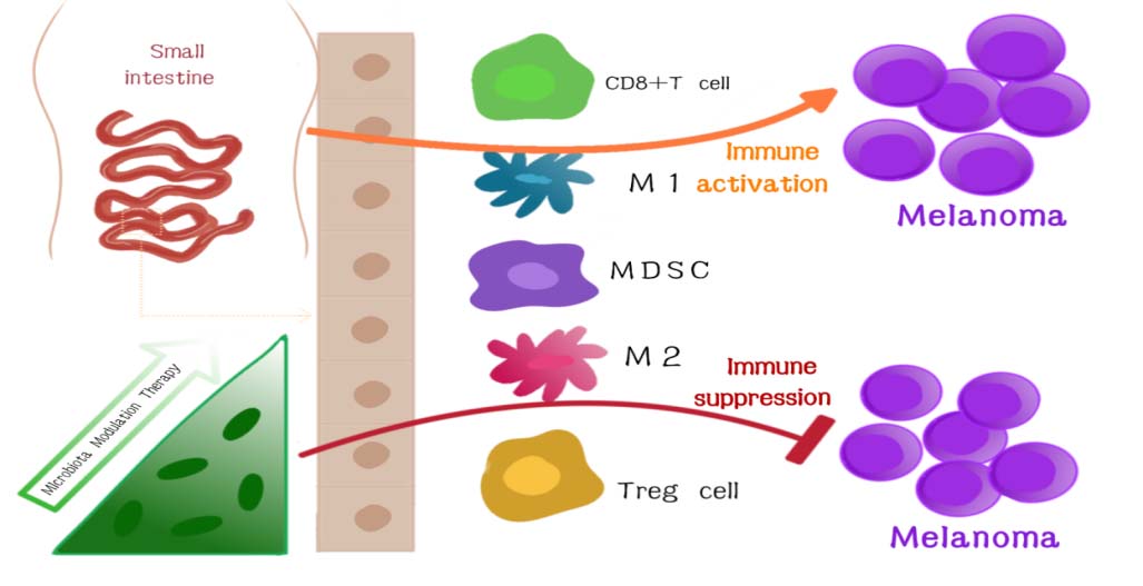 Gut microbiota affects PD-L1 therapy and its mechanism in melanoma.