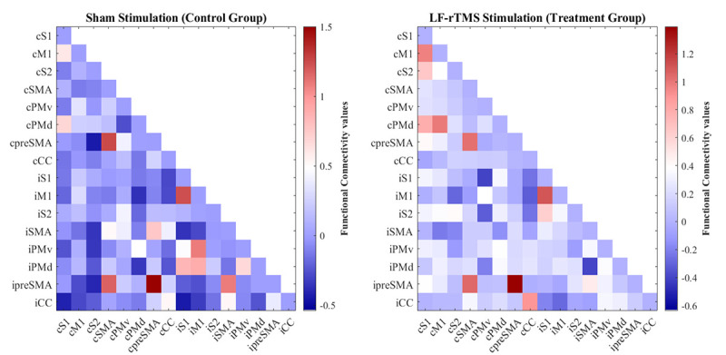 Restoring Functional Connectivity in Hemiplegic Cerebral Palsy: A Study of Low-Frequency rTMS Intervention.