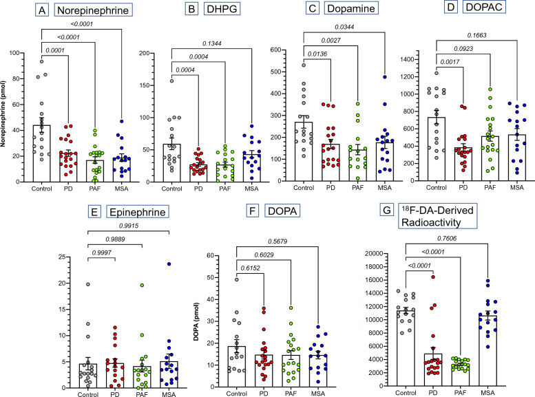 Decreased urinary excretion of norepinephrine and dopamine in autonomic synucleinopathies.