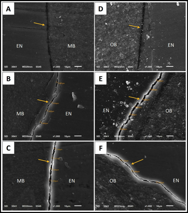 Impact of Different Bleaching Methods on Surface Roughness, Microhardness, and Tooth-Restoration Interface of Ormocer- and Methacrylate-based Restorative Systems.