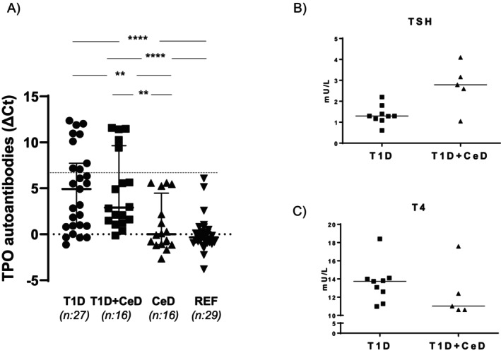 Inflammatory Immune Markers Associated With Thyroid Peroxidase Autoantibodies in Children Diagnosed With Both Type 1 Diabetes and Celiac Disease.