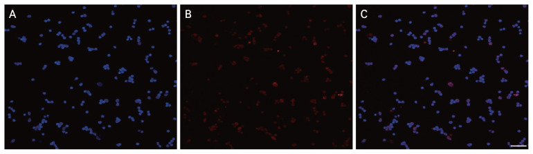 Neuroprotective Mechanisms of Ciliary Neurotrophic Factor in Retinal Ganglion Cells: Insights from Microarray Analysis.