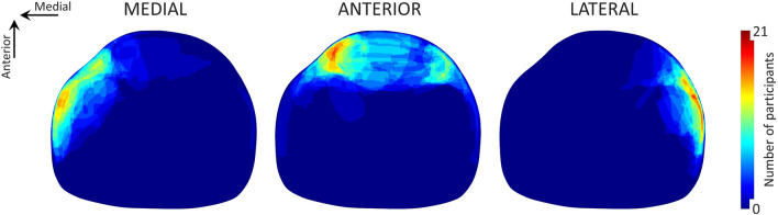 Effect of experimental knee pain location on gait kinematics.