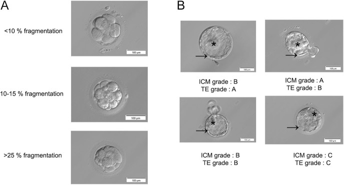 Relative mtDNA copy number in embryo spent culture medium is not a reliable biomarker of human embryo aneuploidy.