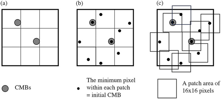 Automated Detection of Cerebral Microbleeds on Two-dimensional Gradient-recalled Echo T2* Weighted Images Using a Morphology Filter Bank and Convolutional Neural Network.
