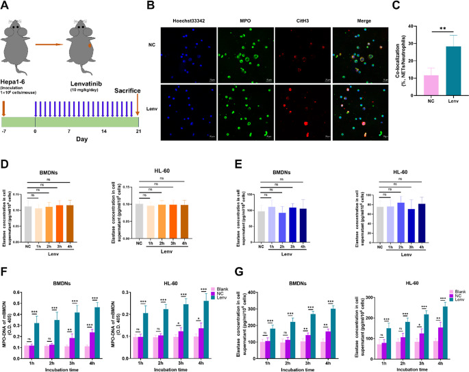 Lenvatinib-activated NDUFA4L2/IL33/PADI4 pathway induces neutrophil extracellular traps that inhibit cuproptosis in hepatocellular carcinoma.