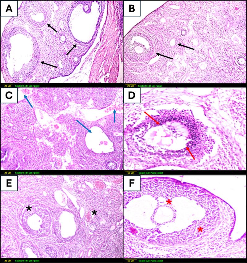Can vildagliptin protect against radiation-induced premature ovarian failure? Insights into the AMPK and AKT signaling pathways.