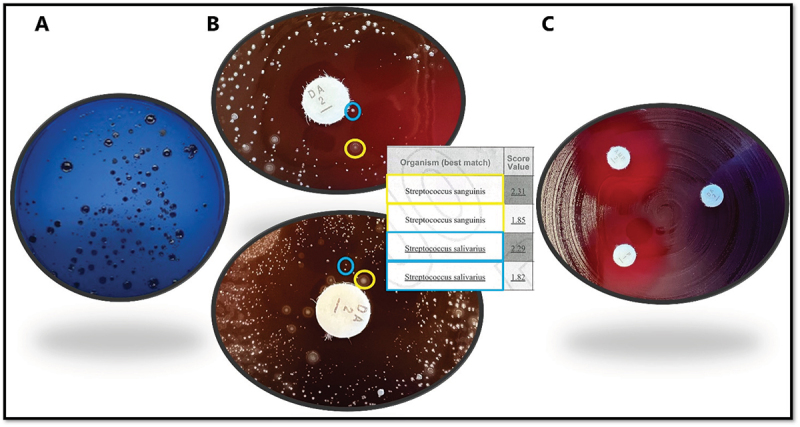 High prevalence of antibiotic resistance of <i>Streptococcus</i> species in saliva from non-hospitalized adults - a pilot study.