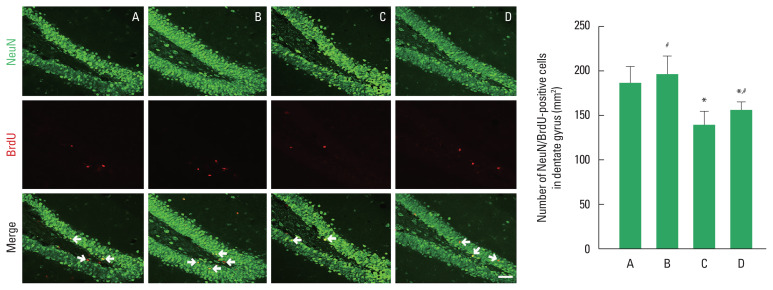 Impact of maternal exercise on neurodevelopment and gut microbiota in offspring from advanced-age mice.