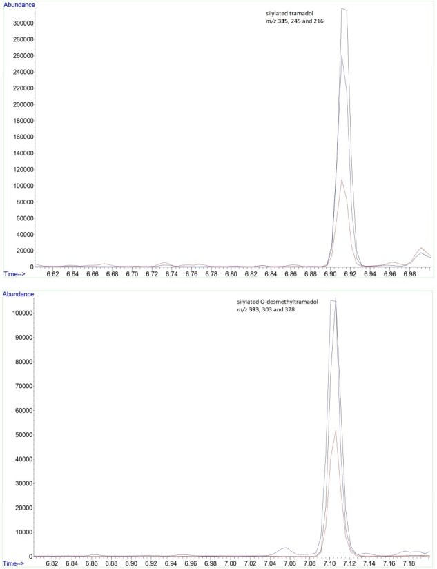 Determination of tramadol and its metabolite O-desmethyltramadol in vitreous humor. Is it helpful in forensic casework?