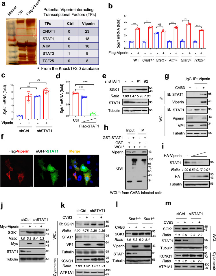 Targeting Viperin prevents coxsackievirus B3-induced acute heart failure.
