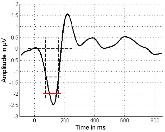 Can Mismatch Negativity Be Used as an Indicator to Predict Central Auditory Deficits in Individuals with Normal Hearing?