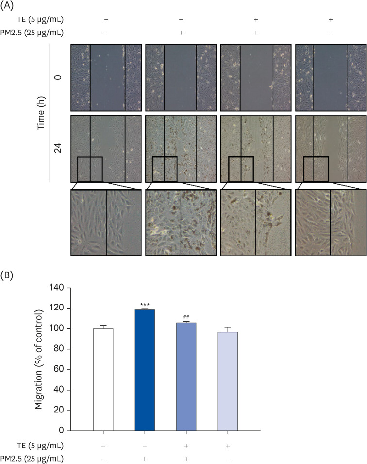 <i>Tagetes erecta</i> Linn flower extract inhibits particulate matter 2.5-promoted epithelial-mesenchymal transition by attenuating reactive oxygen species generation in human retinal pigment epithelial ARPE-19 cells.