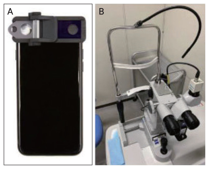 Reliability and Accuracy of Smart Eye Camera in Determining Grading of Nuclear Cataract.