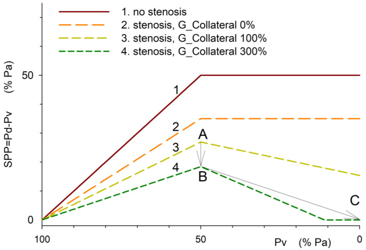The Concept of Venous Steal: The Impact of Vascular Stenosis and Outflow Pressure Gradient on Blood Flow Diversion.