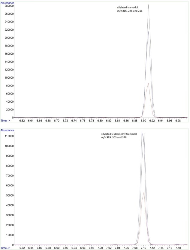 Determination of tramadol and its metabolite O-desmethyltramadol in vitreous humor. Is it helpful in forensic casework?