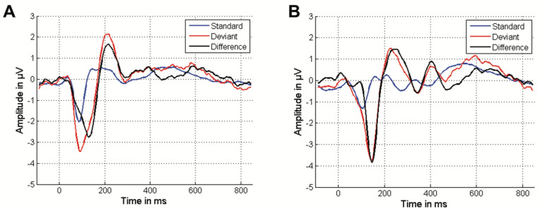 Can Mismatch Negativity Be Used as an Indicator to Predict Central Auditory Deficits in Individuals with Normal Hearing?