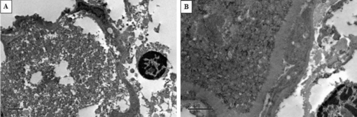 Evaluation of Different Cryoprotectant Combinations in Vitrification and Slow Freezing for Ovarian Tissue Preservation in Domestic Cats.