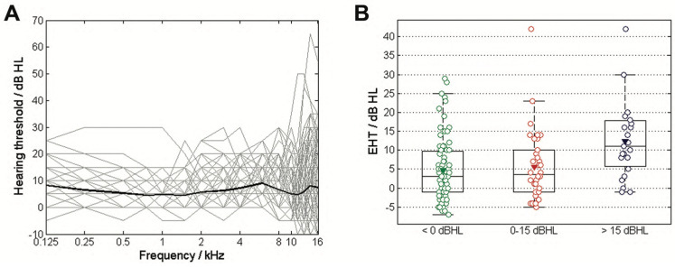 Can Mismatch Negativity Be Used as an Indicator to Predict Central Auditory Deficits in Individuals with Normal Hearing?