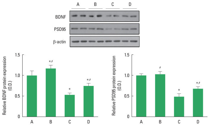 Impact of maternal exercise on neurodevelopment and gut microbiota in offspring from advanced-age mice.