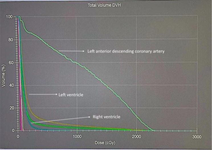 Cardiac substructure dose distributions in node-positive and node-negative breast cancer patients undergoing 3D-CRT: comparing the predictive accuracy of mean heart dose and mean left ventricular dose.