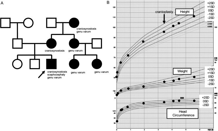 Significance of assessing the severity of craniosynostosis in patients with X-linked hypophosphatemia (XLH) at diagnosis.