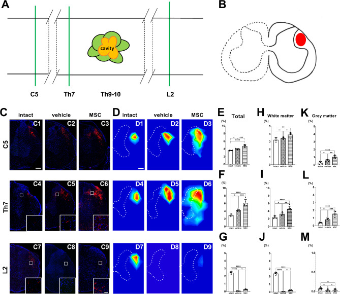 Intravenous infusion of mesenchymal stem cells increased axonal signal intensity in the rubrospinal tract in spinal cord injury.