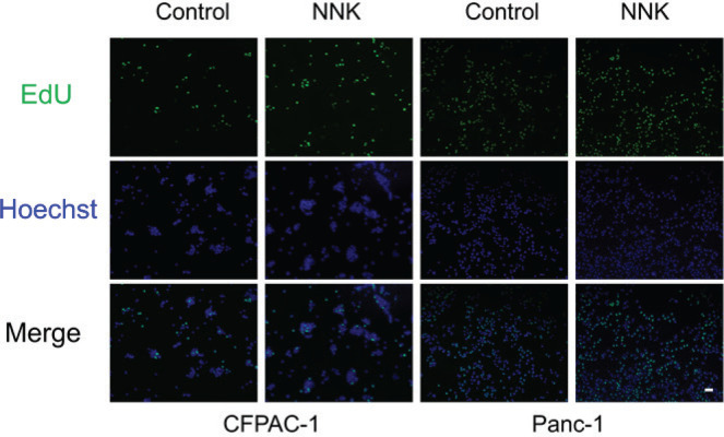 Tobacco carcinogen NNK promotes pancreatic cancer proliferation via LINC00857/β-catenin.
