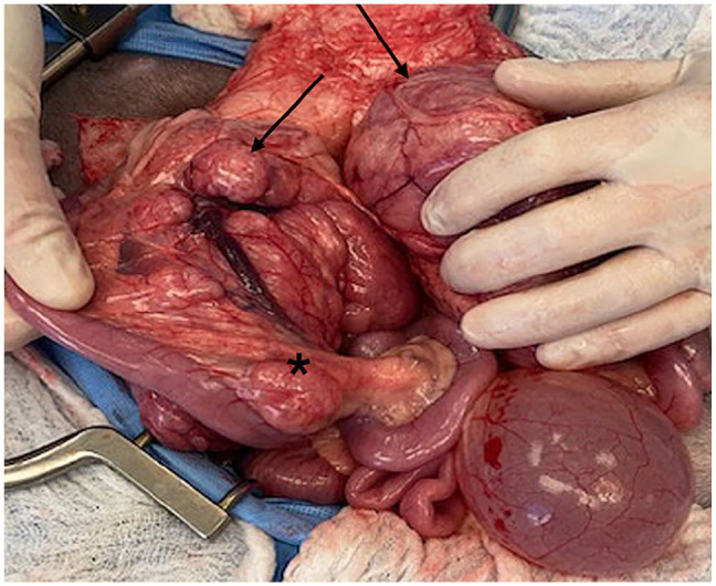 Hyalinizing pancreatic adenocarcinoma in a cat.