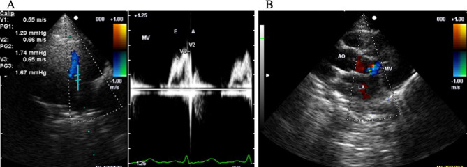 Reference values for cardiac hormones in young Japanese macaques (Macaca fuscat).