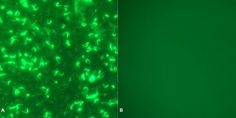 Molecular and serological survey of Trypanosoma vivax in Crioulo Lageano Cattle from southern Brazil.