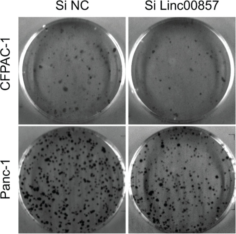 Tobacco carcinogen NNK promotes pancreatic cancer proliferation via LINC00857/β-catenin.