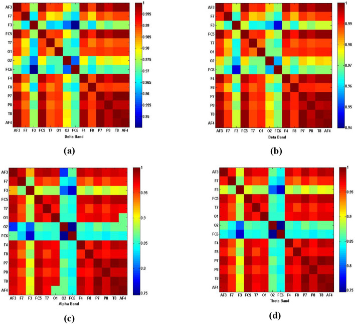 Music interventions and obstructive sleep apnea: a brain connectivity analysis.