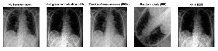 Comparison of Deep Learning Approaches Using Chest Radiographs for Predicting Clinical Deterioration: Retrospective Observational Study.