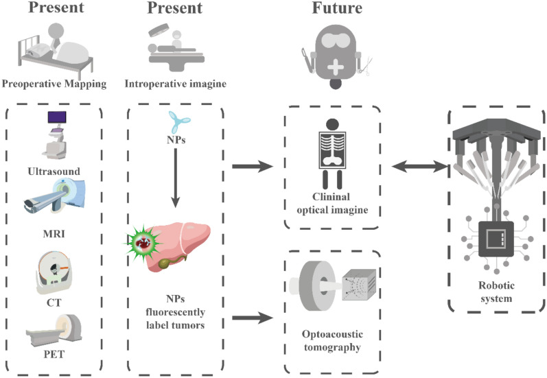 Engineered nanoparticles for imaging and targeted drug delivery in hepatocellular carcinoma.