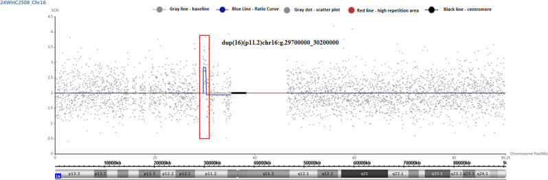 Prenatal diagnosis and molecular cytogenetic analyses of a rare 15q21.3 and 16p11.2 microduplication family.