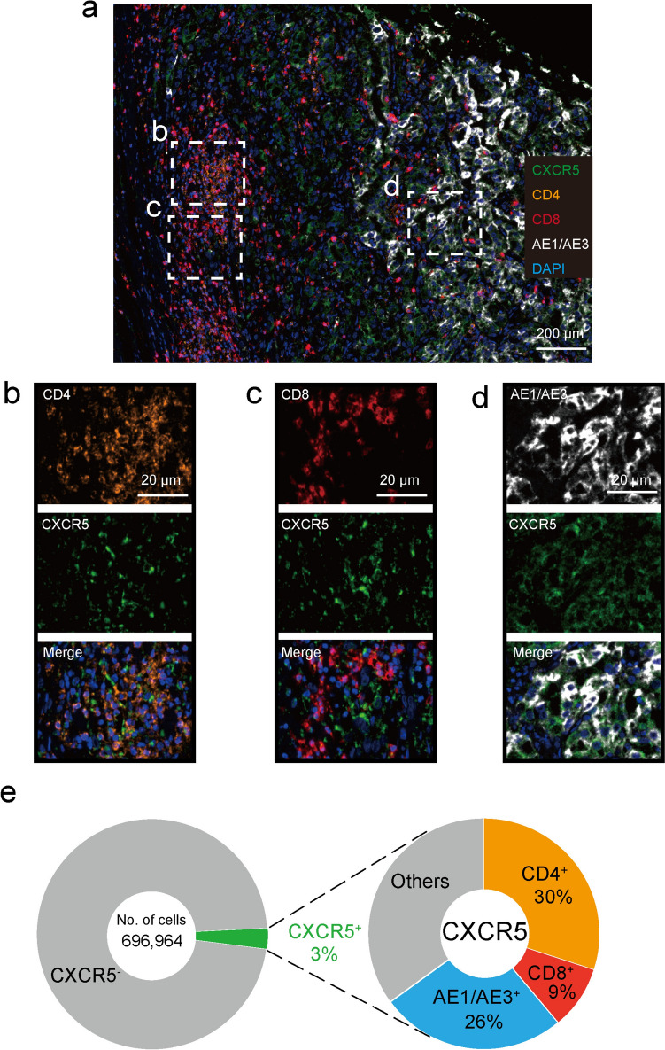 Prognostic impact and landscape of cellular CXCR5 chemokine receptor expression in clear-cell renal cell carcinoma.
