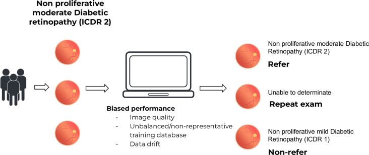 Artificial intelligence, data sharing, and privacy for retinal imaging under Brazilian Data Protection Law.