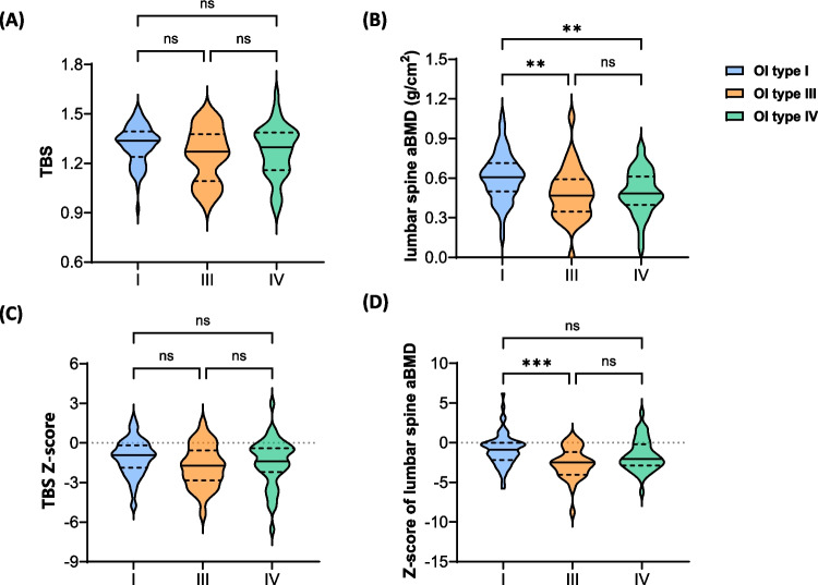 TBS as a complementary tool for assessing vertebral fractures and spinal deformity in children and adolescents with osteogenesis imperfecta.