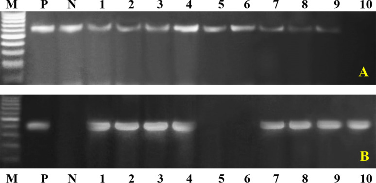 Single nucleotide polymorphisms, gene expression and evaluation of immunological, antioxidant, and pathological parameters associated with bacterial pneumonia in Barki sheep.