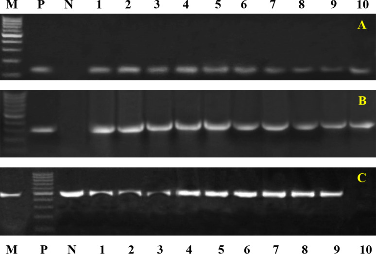 Single nucleotide polymorphisms, gene expression and evaluation of immunological, antioxidant, and pathological parameters associated with bacterial pneumonia in Barki sheep.