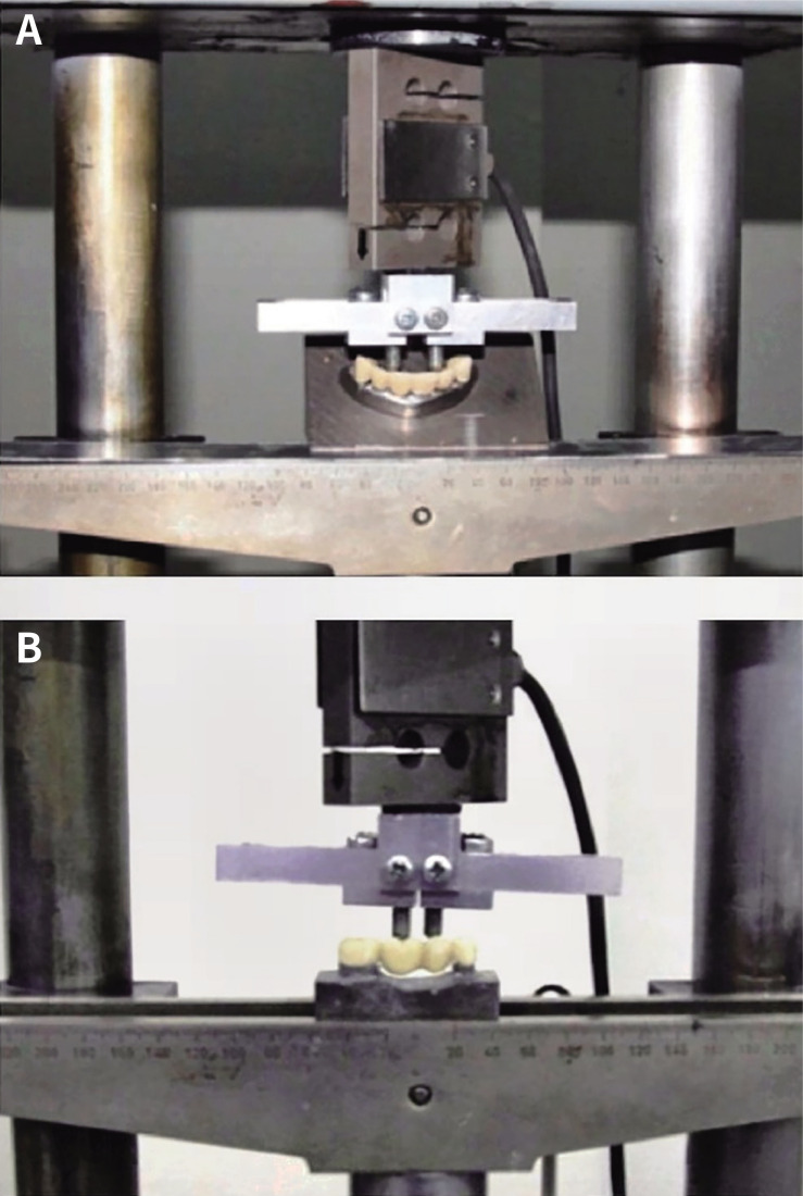 Fracture resistance of fixed partial dentures: the influence of restoration geometry and material in additive manufacturing.
