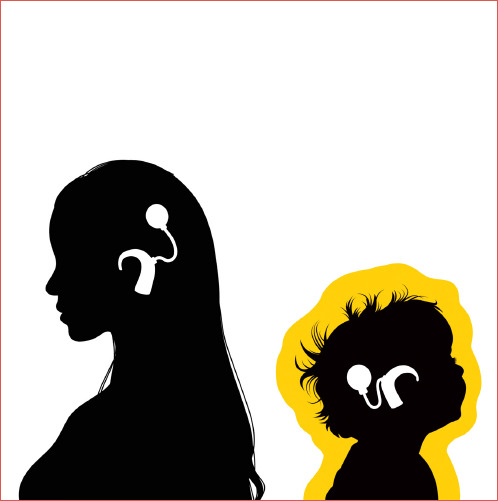 Cochlear Implant (CI) procedure. Italian Clinical Practice Guidelines of the Italian Society of Otorhinolaryngology (SIOeChCF) and Italian Society of Audiology and Phoniatrics (SIAF). Part 2: cochlear implants in children.