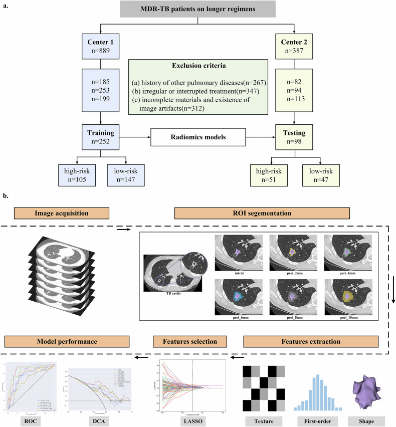 Early treatment monitoring of multidrug-resistant tuberculosis based on CT radiomics of cavity and cavity periphery.