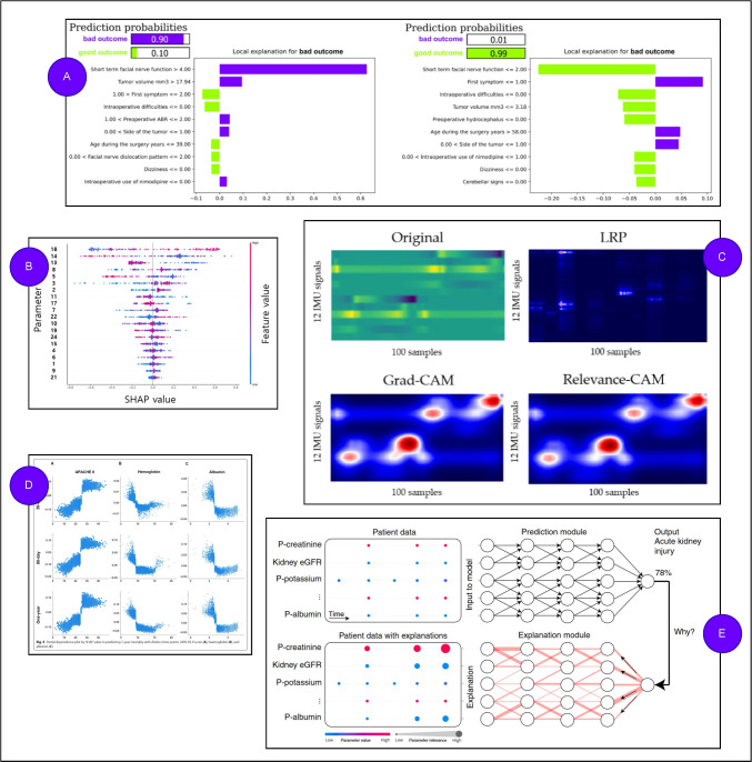 Current methods in explainable artificial intelligence and future prospects for integrative physiology.