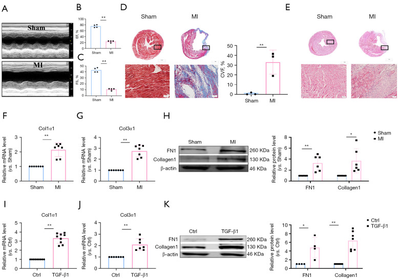 LncRNA-5829: a novel inhibitor of cardiac fibrosis.