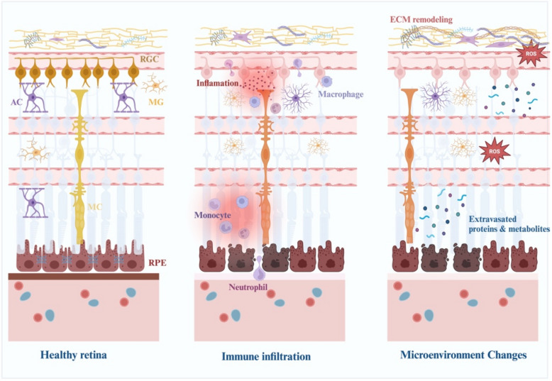 Preserving blood-retinal barrier integrity: a path to retinal ganglion cell protection in glaucoma and traumatic optic neuropathy.