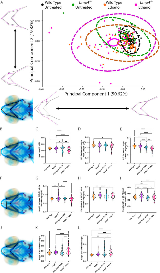 Mutations in the bone morphogenetic protein signaling pathway sensitize zebrafish and humans to ethanol-induced jaw malformations.