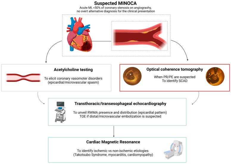 The PROMISE of Precision Medicine in Myocardial Infarction with Non-Obstructive Coronary Arteries.